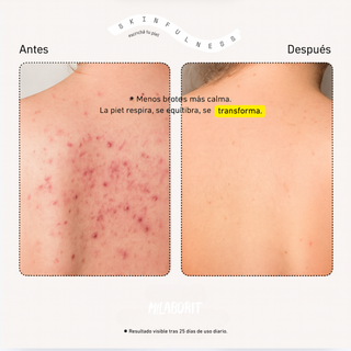 UltraBalance5+ Serum